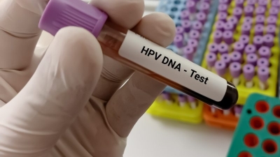 Greek health ministry dodges key questions over EU-funded HPV test project